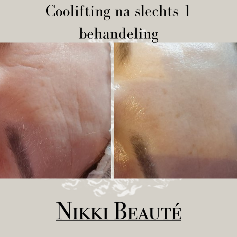 iBeauty Salon Nikki BEAUTÉ afbeelding 4