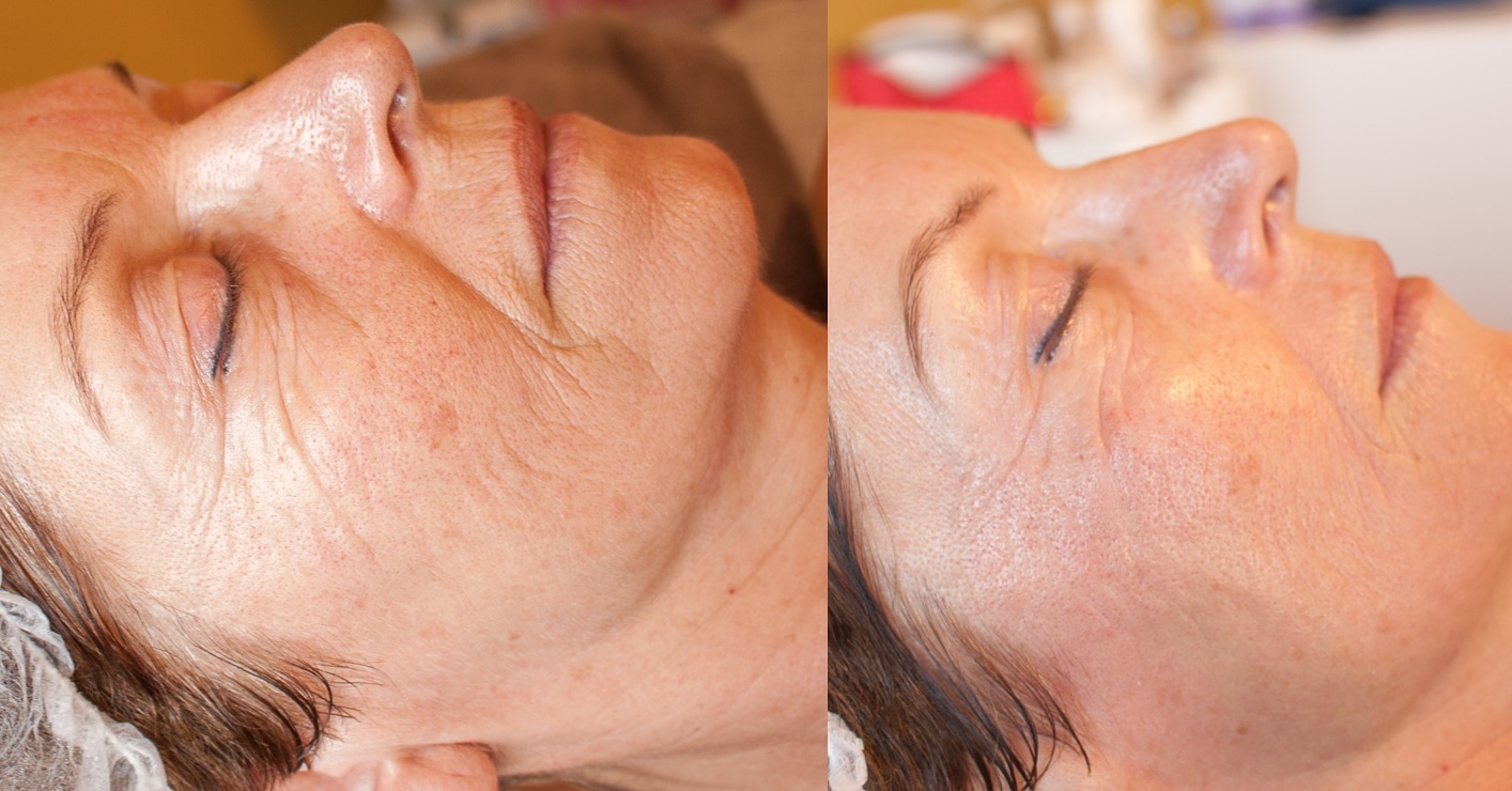 iBeauty Salon Elvée beauty afbeelding 2