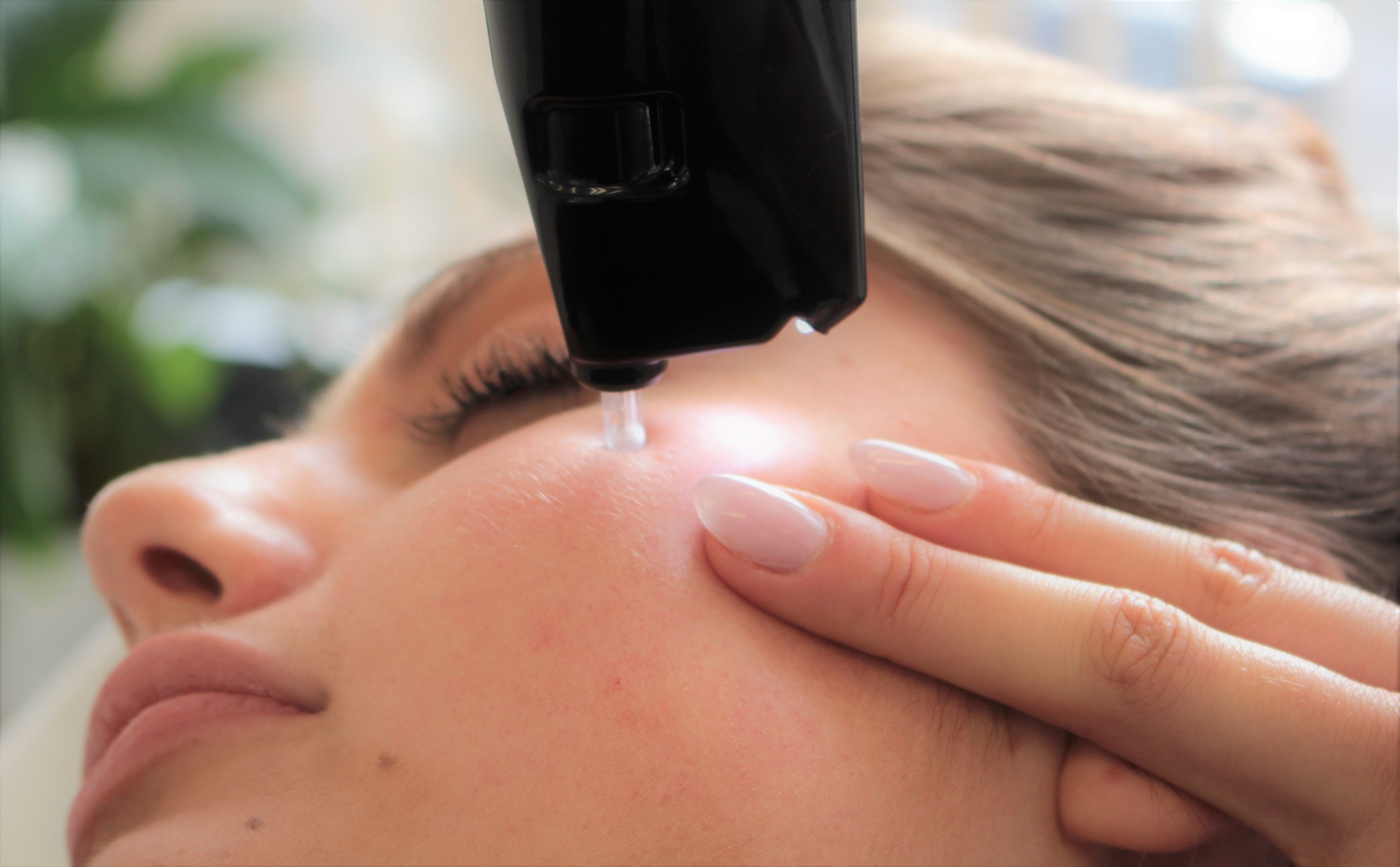 iBeauty Salon VITA Skin Therapy / Huid- en laserkliniek  afbeelding 1