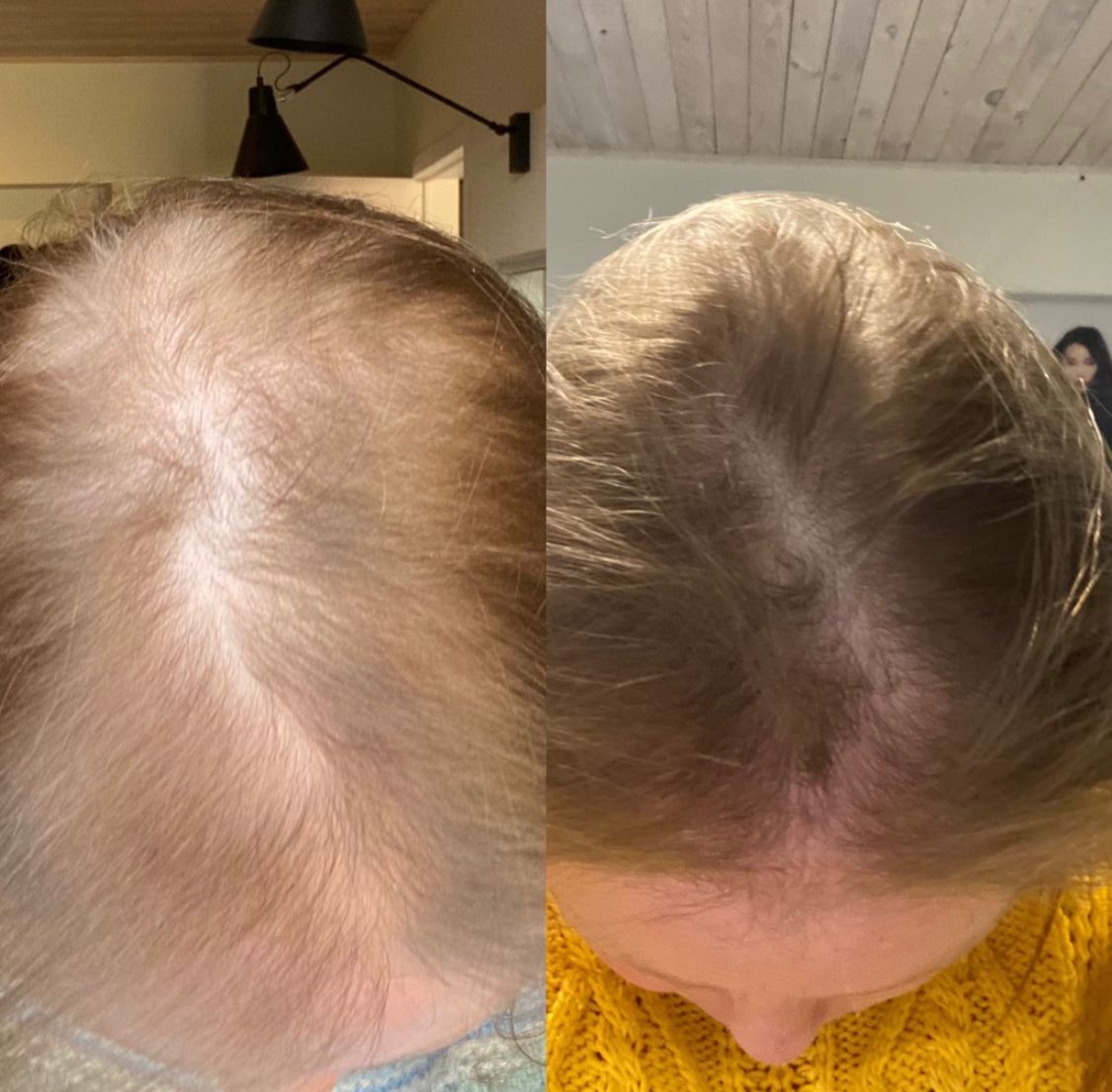 Tripeptide Collageen + Vitamine C - Lier