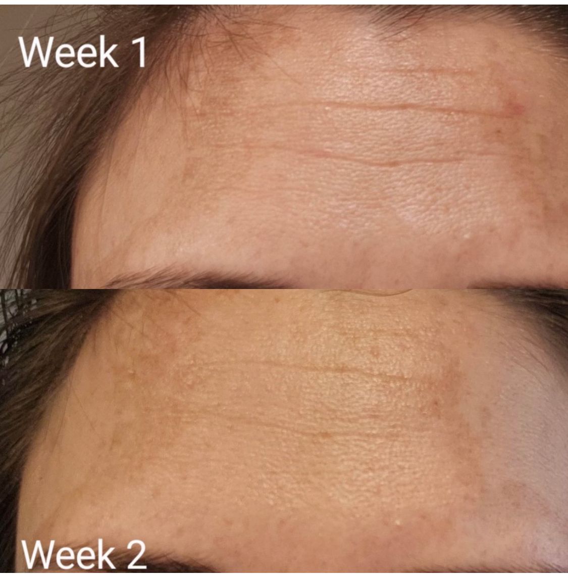 Tripeptide Collageen + Vitamine C - Lier