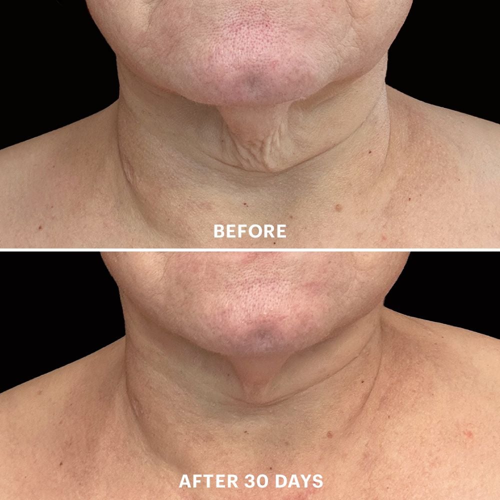 Bio Renew EGF Neck-Cream - Mechelen
