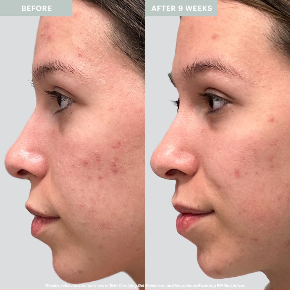 BHA Clarifying Gel Dag/Nachtcreme - Mechelen