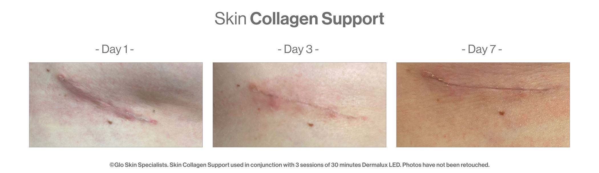 Skin Collagen Synergy (4x28caps) - Turnhout