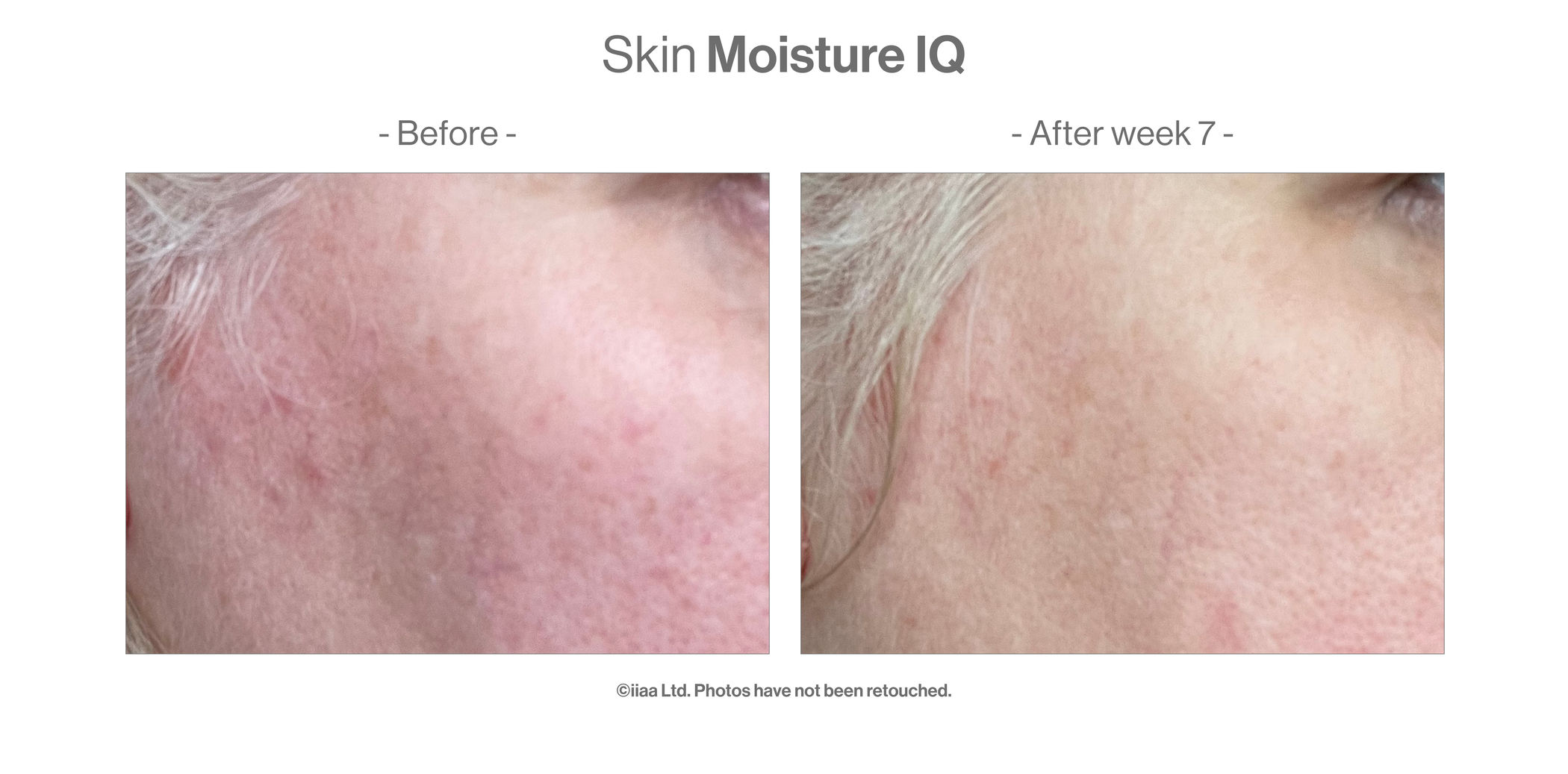 Skin Moisture IQ (28 portions) - Turnhout