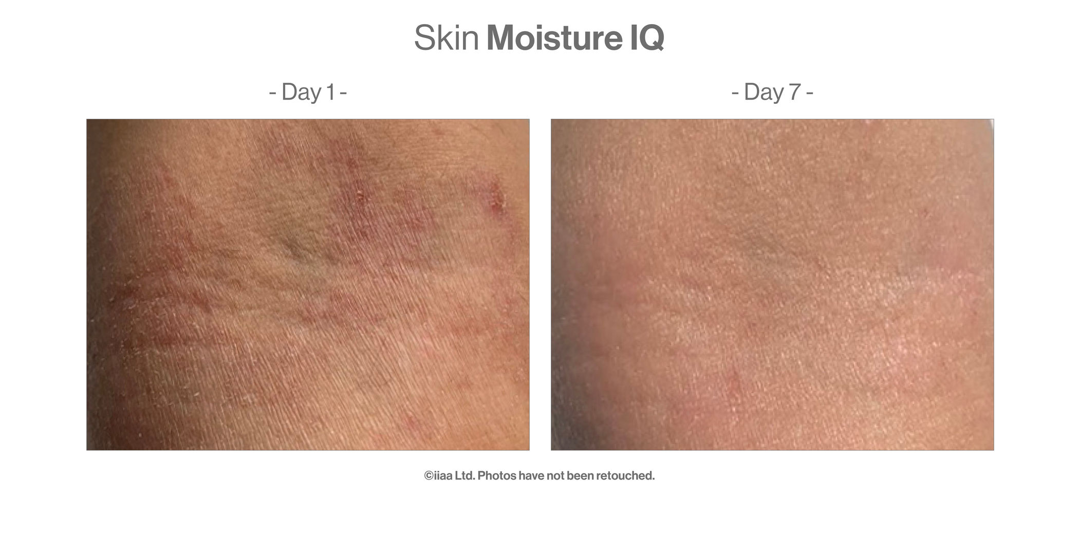 Skin Moisture IQ (28 portions) - Turnhout