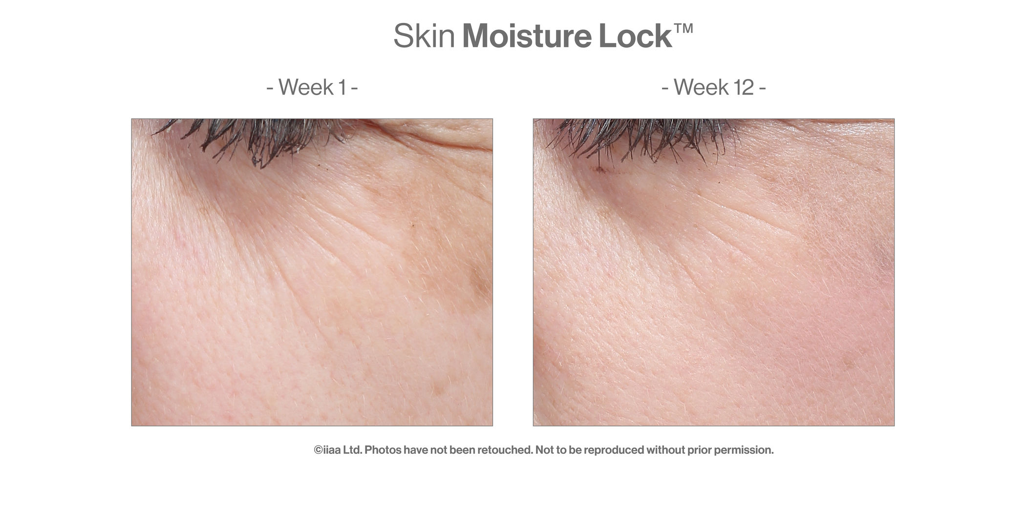 Skin Moisture Lock (60 caps) - Turnhout