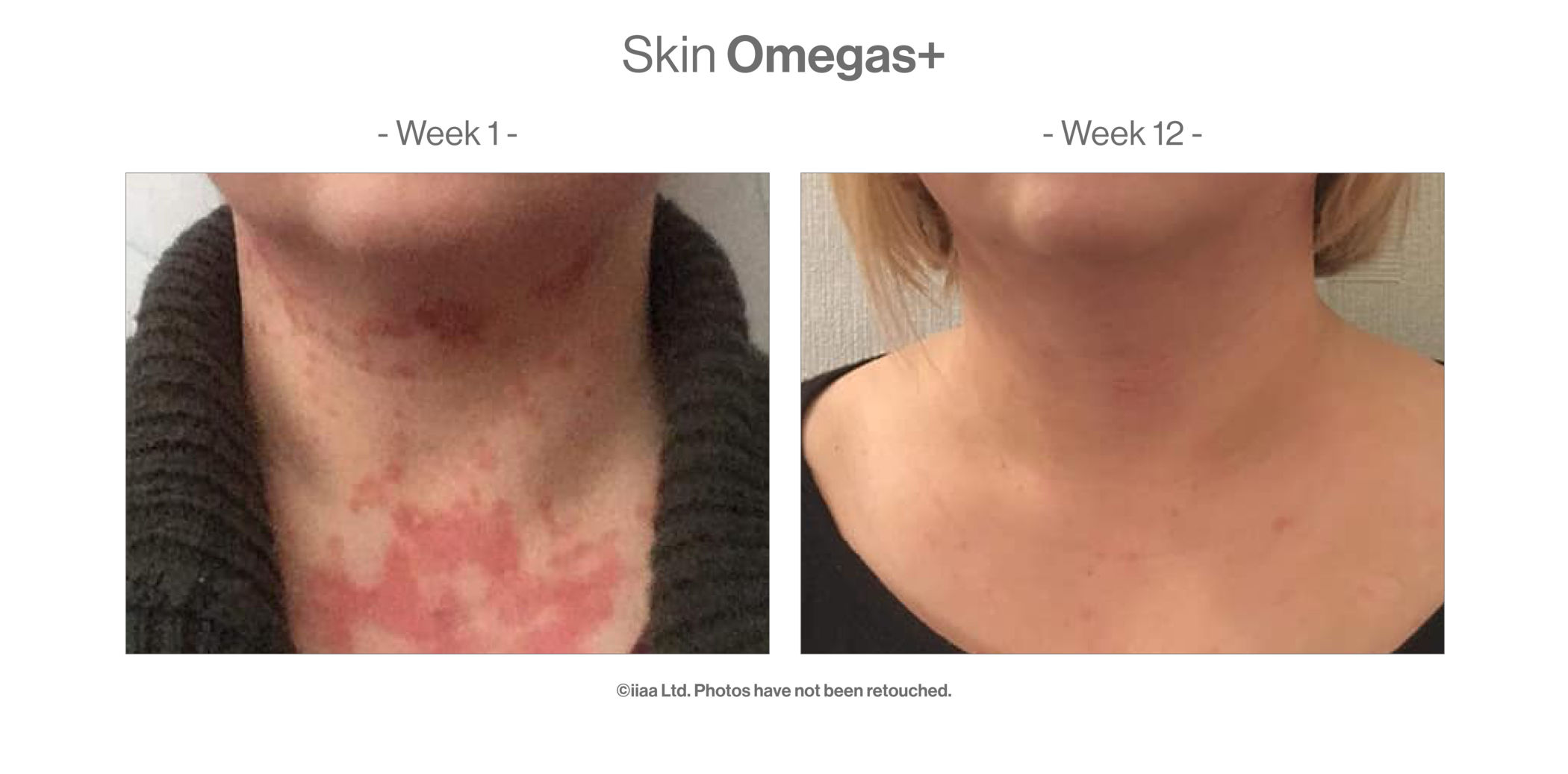 Skin Omegas+ (60 caps) - Turnhout