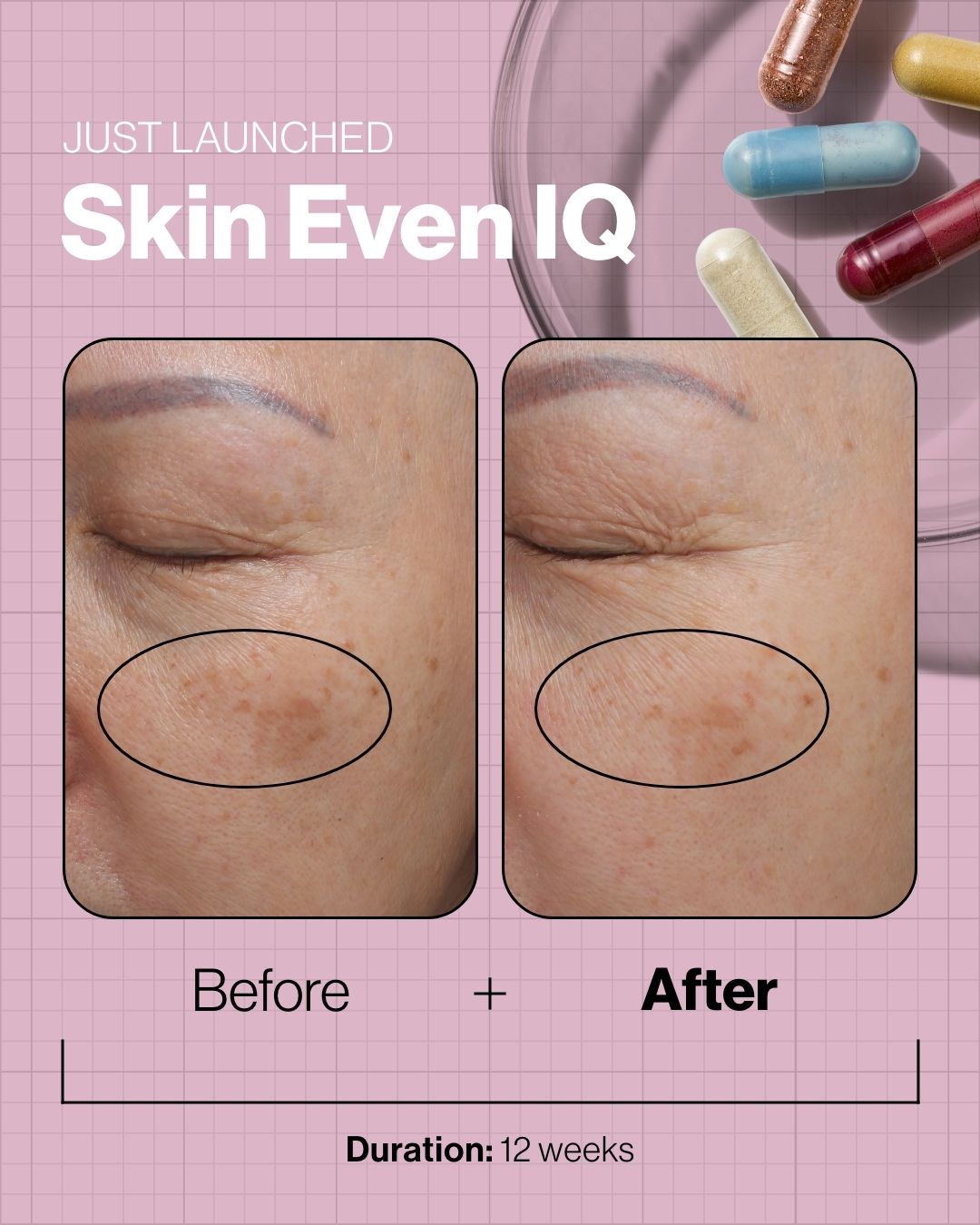 Skin Even IQ (140 portions) - Turnhout