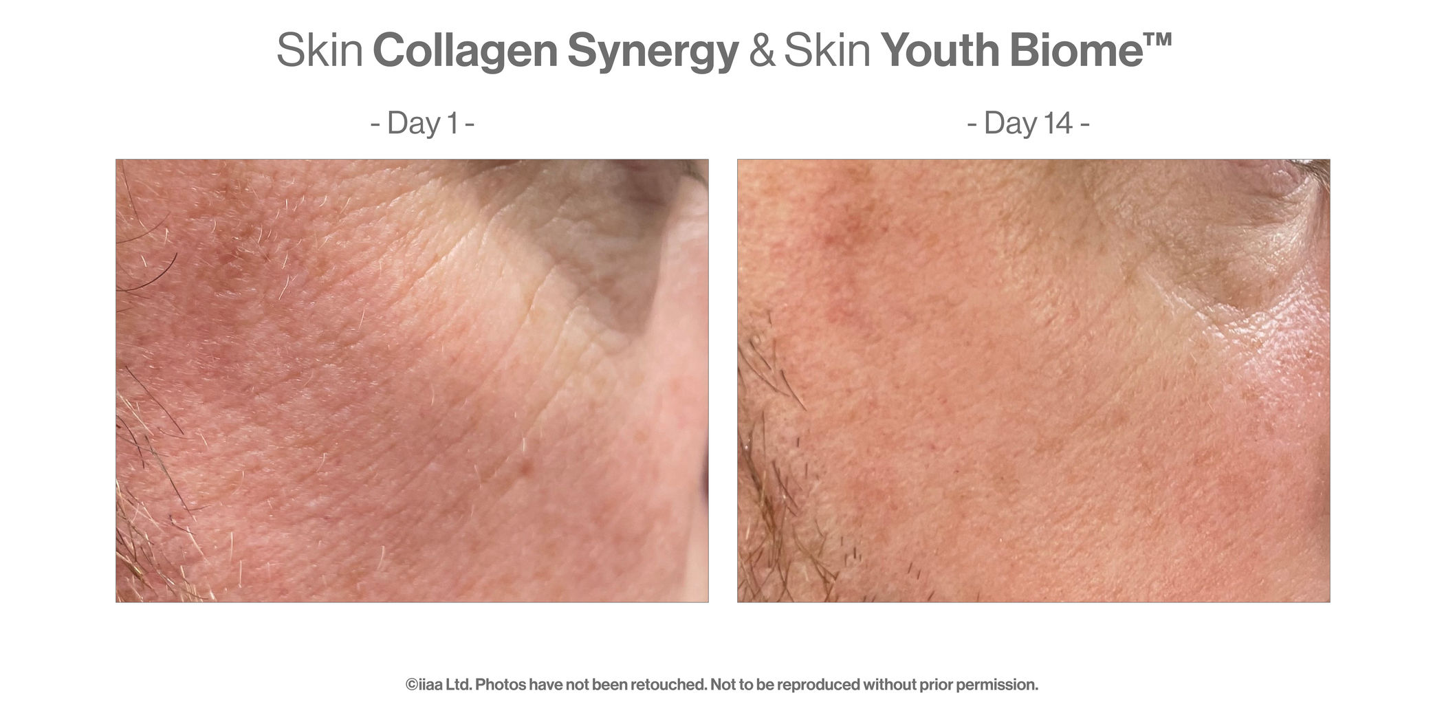 Skin Collagen Synergy (4x28caps) - Turnhout