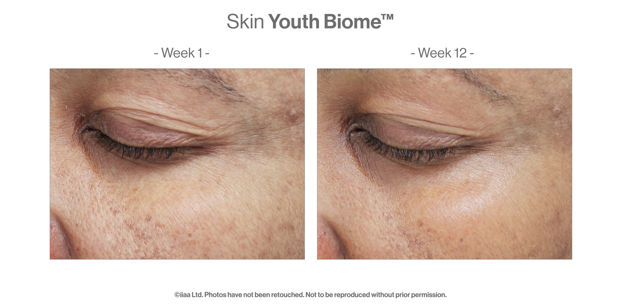 Skin Youth Biome (60 caps) - Turnhout